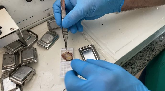 Preparación de muestras y biopsias para diagnóstico anatomopatológico